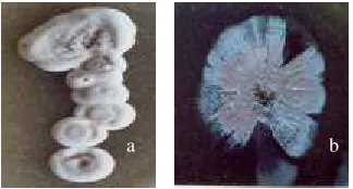 Gambar 1. Koloni Streptomyces sp. a) KS-1 yang memperlihatkan pigmen putih  dan b) IVNF1-1  yang memperlihatkan pigmen putih dan merah muda