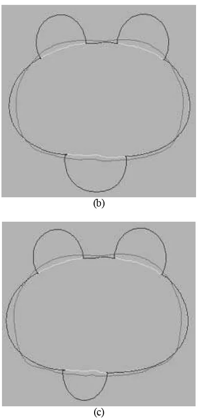 Figure 3. The contours results of Balloon Approach  