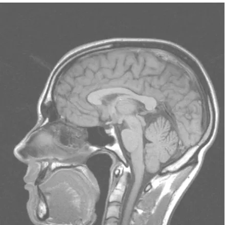 Gambar 4 adalah contoh gambar MRI dari kepala manusia.  