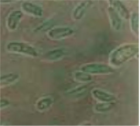 Gambar 16. Mikrokonidia F. oxysporum pada Media PSA dengan                         pH 8 