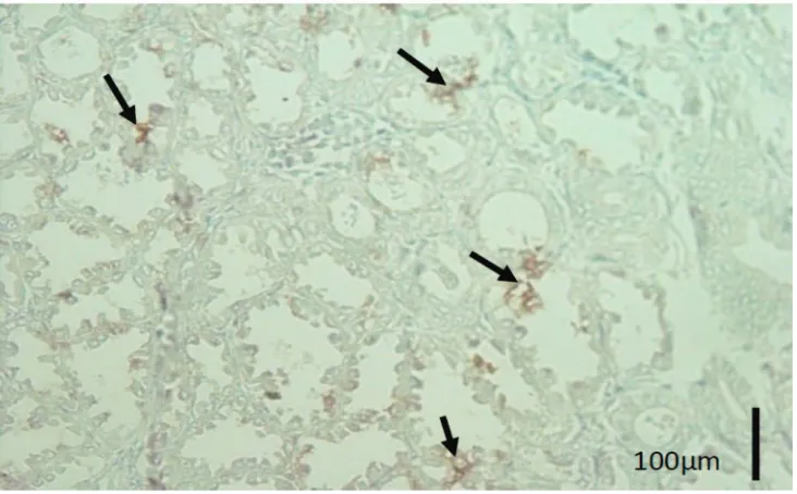 Gambar 1.  Gambaran imunopatologis imunohistokimia streptavidin biotin dengan antibodi poliklonal anti-nukleoprotein avian inluenza virus (AIV) pada ayam petelur komersial dengan gejala klinis tortikolis, paralisis kaki dan hemoragis proventrikulus