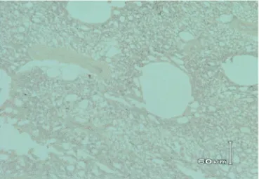 Gambar 3. Gambaran imunopatologis imunohistokimia streptavidin biotin pada paru-paru ayam petelur komersial dengan gejala klinis tortikolis, paralisis kaki dan hemoragis pada proventrikulus sebagai kontrol negatif