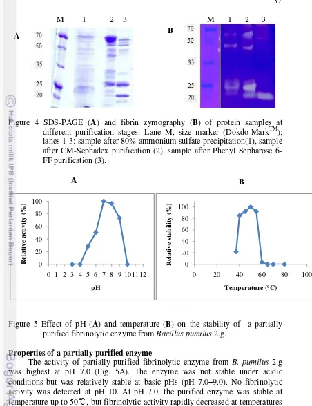 Figure 4 SDS-PAGE (A) and fibrin zymography (B) of protein samples at TM