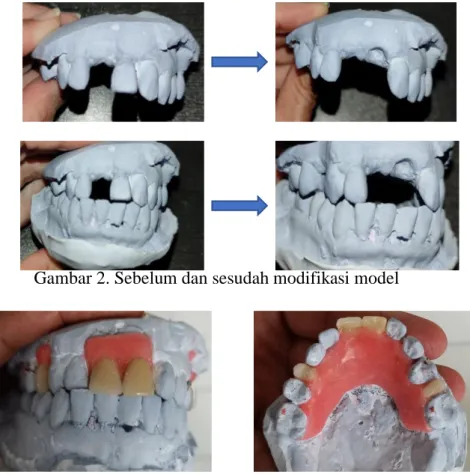 Gambar 2. Sebelum dan sesudah modifikasi model 