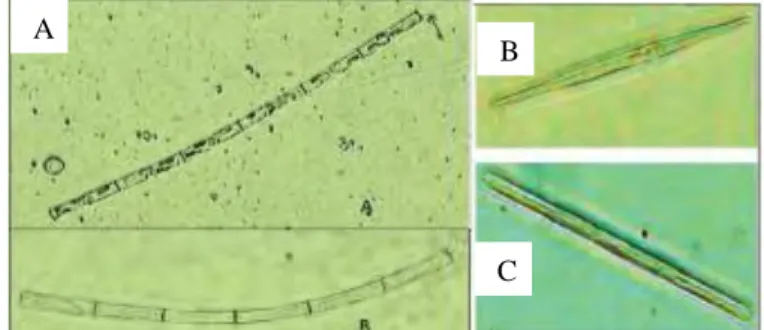 Gambar 2.1 Fitoplankton Kelas Diatom (A) Aulacoseira sp. (B) Diatoma  elongatum (C) Synedra ulna 