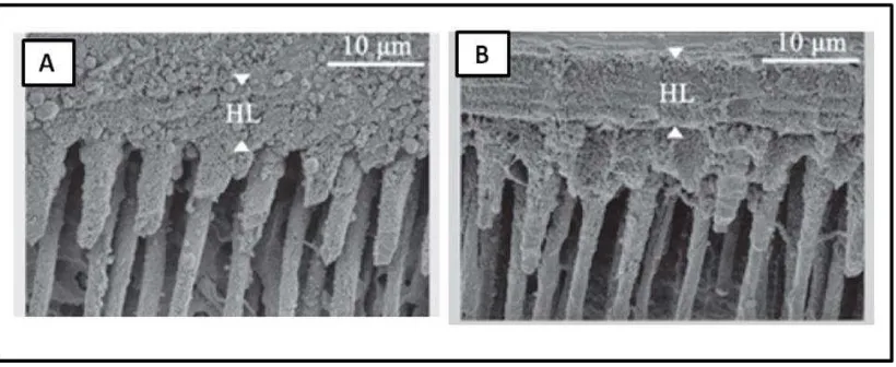 Gambar 8. SEM A. Permukaan dentin yang dilakukan water wet-bonding B. Permukaan dentin yang dilakukan ethanol wet-bonding