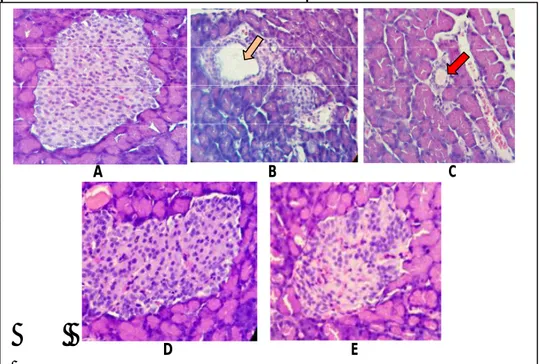 Gambar  7.  Penampang  Histologi  Pankreas  Perbesaran  40x10  dengan  Pewarnaan  Hematoksilin  Eosin  setelah  28  hari  perlakuan