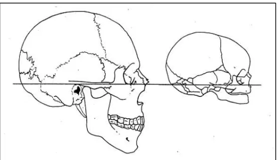 Gambar 1. Ukuran relatif dari wajah dan kranium sewaktu                         bayi dan pada dewasa14  