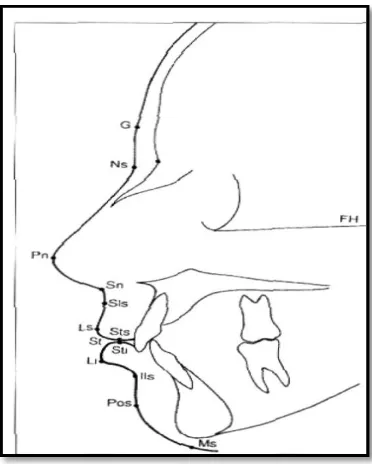 Gambar 2. Sefalometri frontal3 