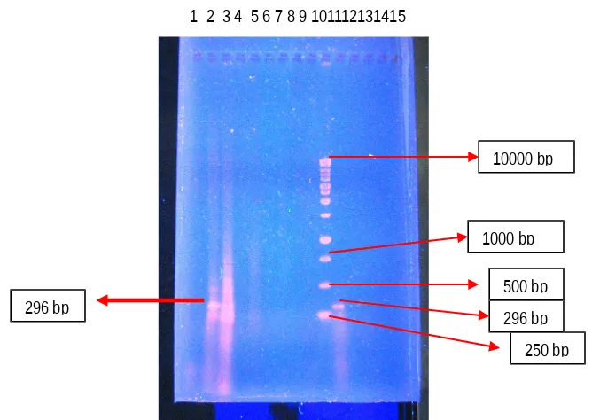 Gambar 1.  DNA WSSV (296 bp) dari produk Nested PCR sampel udang windu