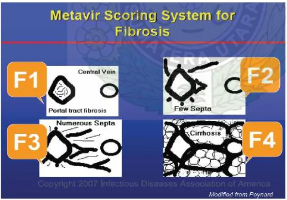 Gambar 6. Skor Metavir pada fibrosis hati 