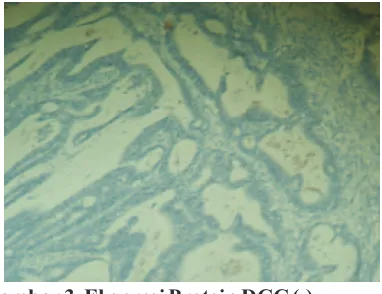 Gambar 3  Ekspresi Protein DCC (-)