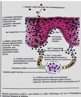 Gambar 2.1 Mekanisme terjadinya dermatitis kontak 
