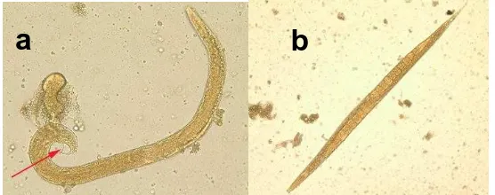 Gambar 2.9 Cacing Strongyloides stercoralis dewasa. (a) jantan (memiliki spekulum), (b) betina (http://dpd.cdc.gov/dpdx/html/ImageLibrary/Strongyloidiasis_il.htm) 