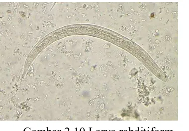 Gambar 2.10 Larva rabditiform (http://www.wadsworth.org/testing/parasitologyD/Strongyloides.shtml) 