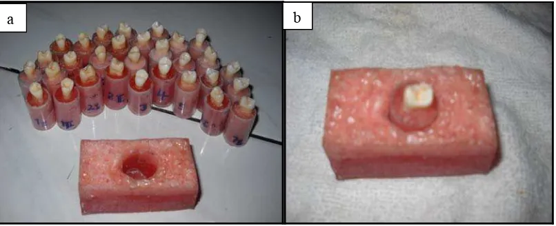 Gambar 8. Sampel gigi yang ditanam dalam spuit serta cetakan balok akrilik (a),    posisi spesimen saat dimasukkan ke dalam cetalan balok akrilik (b)          