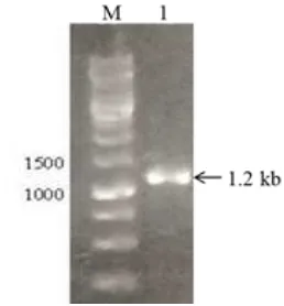 FIGURE 2 Selec�on of recombinant clones. (a) Blue-white screening of E.coli TOP10 transformants, (b) Size screening of recombinant clones,B: plasmid from blue colony, W1: recombinant plasmid from white colony