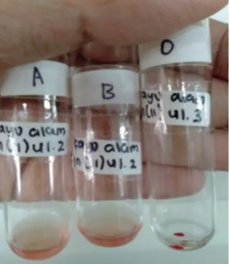Gambar  4.  Hasil  pengamatan  pada  metode  absorbsi  elusi:  hasil  positif  (tabung  O)  hasil  negative  (tabung  A  dan  B)  (sumber:  dok  pribadi,  2021)