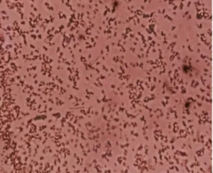 Gambar 1. Hasil uji pewarnaan gram bakteri P. fluorescens dengan perbesaran 1000 x 