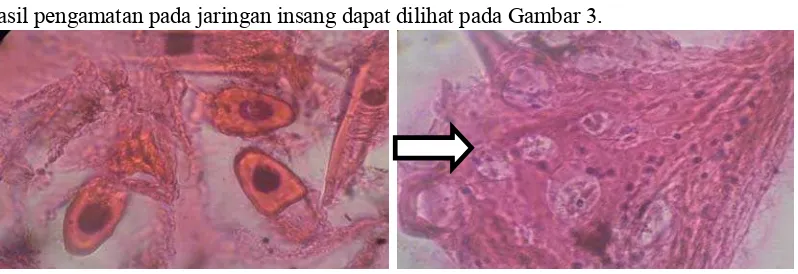 Gambar 3.   Patologi insang ikan Kardinal Banggai dengan pewarnaan H-E (A) Menunjukkan insang dengan kondisi normal