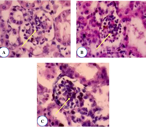 Gambar 11. Pembesaran glomerulus (panah kuning) pada kelompok perlakuan 1 (A), 