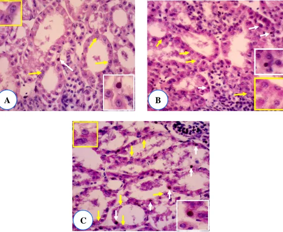 Gambar  14.  Nekrosis  (panah  kuning)  dan  apoptosis  (panah  putih)  pada  kelompok 