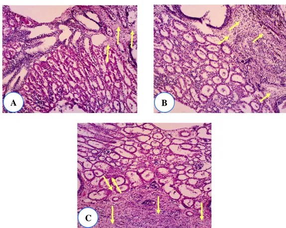 Gambar 15. Fibrosis di interstitium ginjal (panah kuning) pada kelompok perlakuan 1 