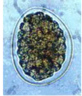 Gambar 5. Buccal Capsule pada cacing tambang  A. duodenale (A) dan N. americanus (B), telur cacing (C)