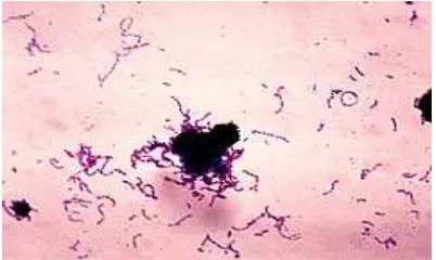 Gambar 2. Streptococcus mutans28