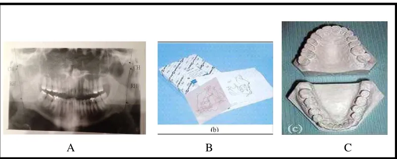 Gambar 14.  Bahan yang digunakan. (A) OPG, (B) Kertas asetat tebal 0.003 inchi, (C) Model studi 
