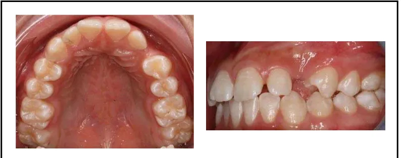 Gambar 13.  Foto intra oral sebelum perawatan.13