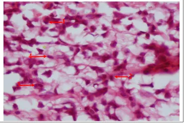 Gambar 3.1 Jaringan granuloma ditemukan sel datia (1), limfosit (2), makrofag (3), Fibroblas (4) dan Sel plasma (5)(HPA 400X)