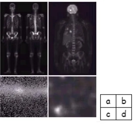 Gambar 1.5. X-Ray Imaging 