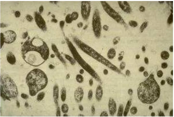 Gambar 2.2 Morfologi bakteri Liberobacter (Aubert, 1989) 