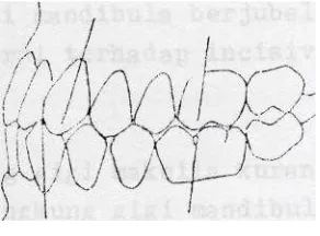 Gambar r 1 1. 