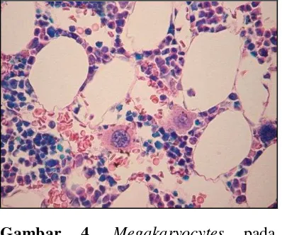 Gambar 4. Megakaryocytes pada sumsum tulang.12 