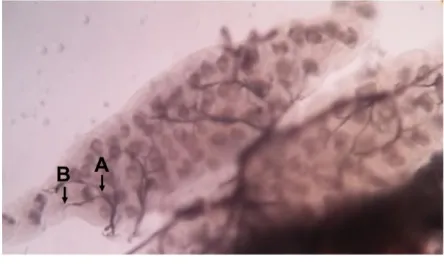 Gambar 2.  Ovarium Nyamuk Culex sp Betina 