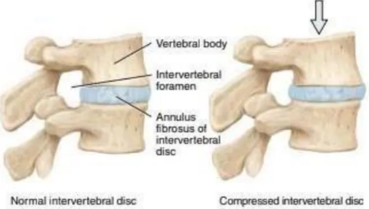 Gambar 2.4 Discus intervertebralis. 