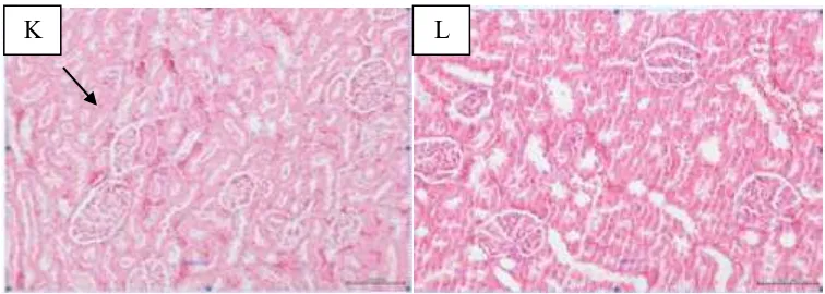 Gambar 6. Histologis tubulus ginjal tikus skor 2 (G) dan skor 3 (H) pada kelompok perlakuan dosis 100 dengan pewarnaan H&E skala 100 µm 