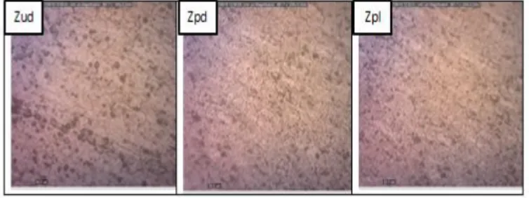 Gambar 6 Foto Micro Daerah Zpl, Zpd (HAZ) dan Zud pada Variasi 4000 Rpm dan 60 S pada 8 Mpa 