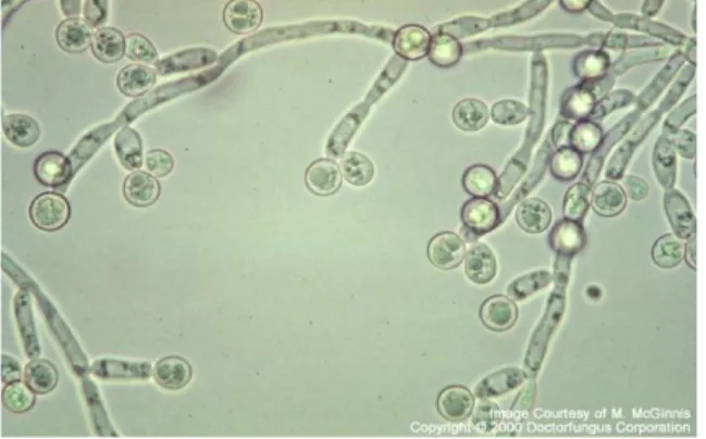 Gambar 2.2 Candida albicans 