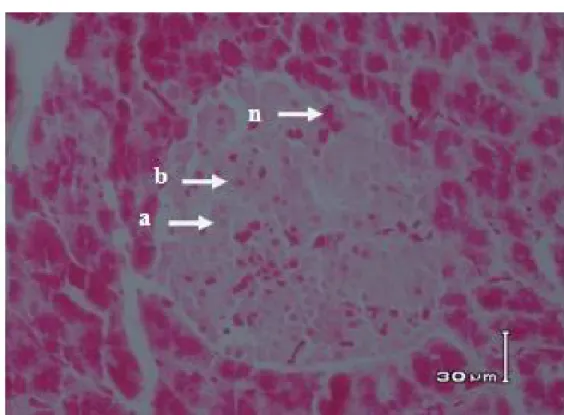 Gambar 3. Nekrosa Sel β Pankreas pada Perlakuan B ; a = sel alpha pankreas normal, b = sel beta pankreas  normal,  dan  n  =  sel  beta  pankreas  yang  mengalami  nekrosa,  (Pewarnaan