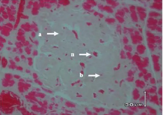 Gambar 4. Nekrosa Sel β Pankreas pada Perlakuan C ; a = sel alpha pankreas normal, b = sel beta pankreas  normal,  dan  n  =  sel  beta  pankreas  yang  mengalami  nekrosa,  (Pewarnaan