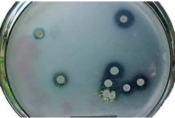 Gambar 1. Beberapa koloni bakteri pelarut fosfat (BPF) tumbuh pada media selektif agar Pikovskaya yang membentuk zona bening dengan kejernihan dan diameter yang berbeda-beda  2.6.2.2 Uji pelarutan P pada media cair  