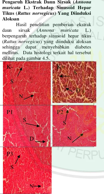 Gambar 4.5 Histologi Sinusoid hepar tikus (Rattus norvegicus) jantan     (perbesaran 400x, pewarnaan HE)
