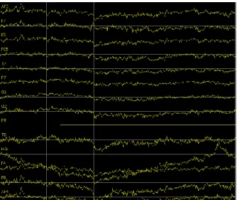 Gambar 3.1B. Contoh data sinyal EEG pada konsentrasi tinggi 