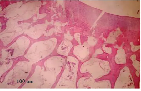 Tabel 2  Analisis Perbandingan Gambaran Histopatologis Kartilago OA Lutut Kelinci yang     Diberikan Fraksinasi SSP dengan yang Tidak diberikan Fraksinasi Sarang Semut   