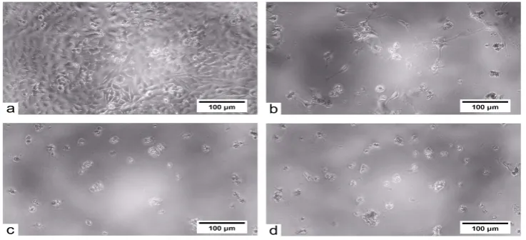 Fig. 1 Microscopic Appearance of Parental HeLa Cells of Untreated (Control) (a) and Treated with Ethanol Extract of Stylissa carteri with the Following Concentrations: 5 ppm (b), 50 ppm (c), and 100 ppm (d) (Magnification 100x)