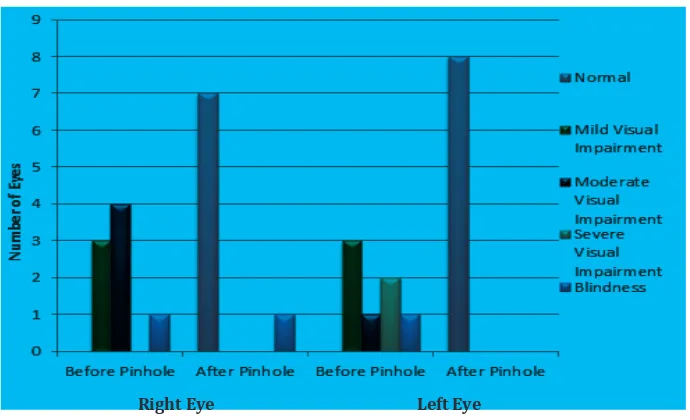 Table 4 Causes of Visual Impairment of Drivers 