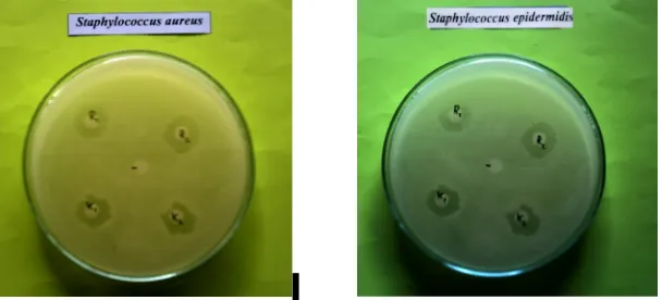 Gambar Hambatan antibakteri senyawa X terhadap koloni  aStaphylococcus aureus ATCC 6538b (a),Hambatan antibakteri senyawa X terhadap koloni Staphylococcus epidermidis ATCC 12228(b).